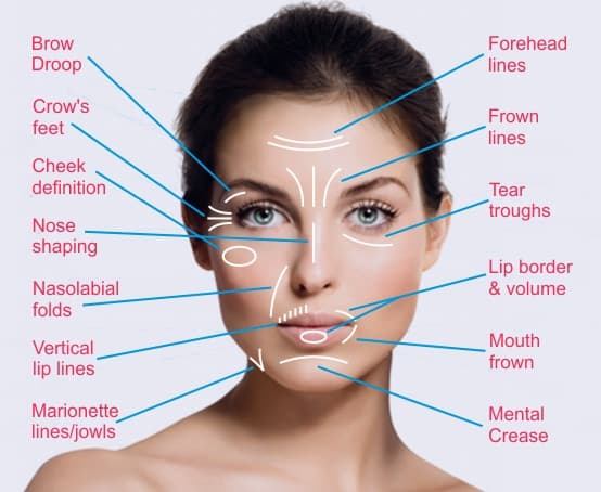 botox-treatment