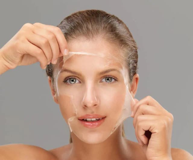 chemical-peel