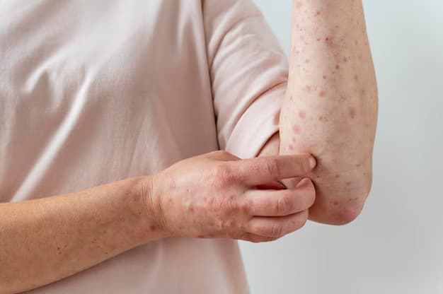 Eczema Treatment