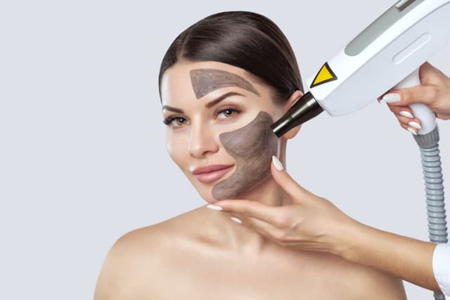 Carbon Laser Facial Peel